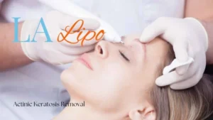 Woman receiving Actinic Keratosis Removal Treatment Northamptonshire