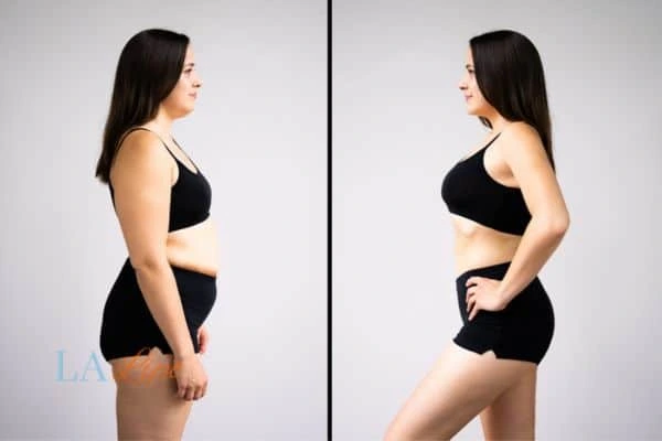 LA-EMS Body Sculpting Northamptonshire results before and after of womans results on body toning.