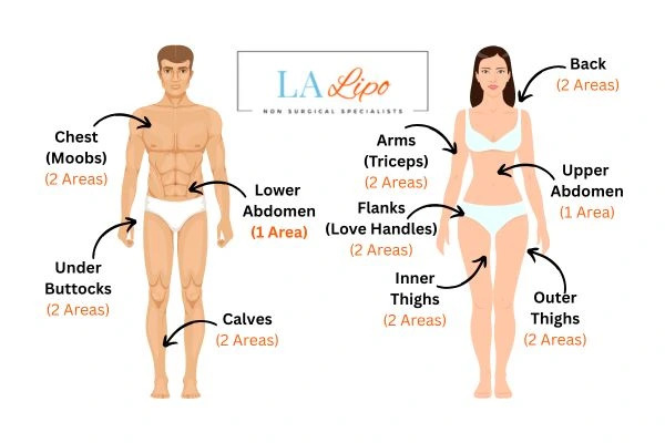 LA LIPO Cryolipolysis Areas Northamptonshire