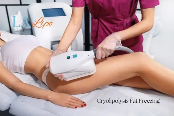 Woman receiving coolsculpting Northamptonshire treatment on her thighs