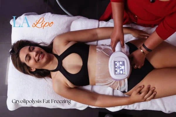 woman getting cryolipolysis Northamptonshire