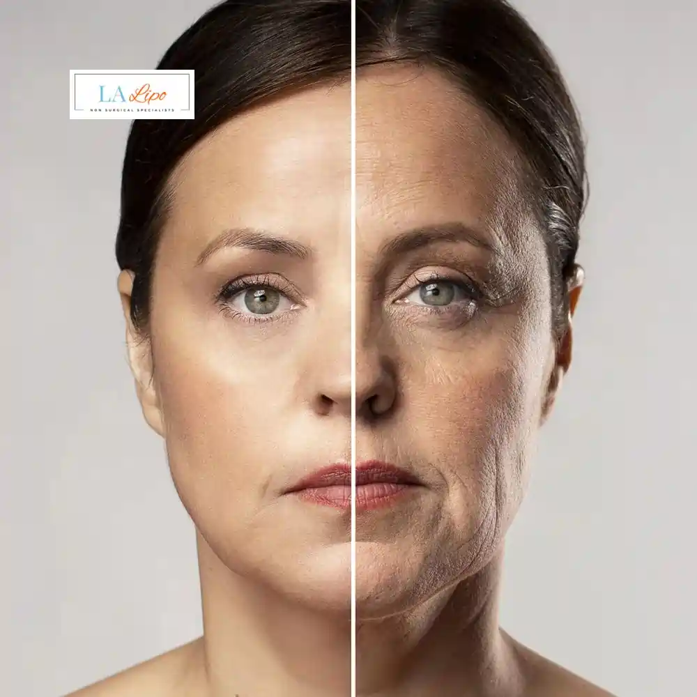 How Can You Tell If Non-Surgical Skin Tightening Is Right for You Northamptonshire?