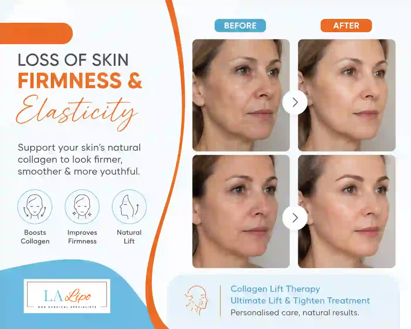 Sign #7: Loss of Skin Firmness and Elasticity Northamptonshire
